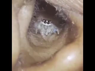 spider in ear